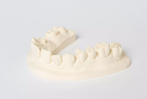 Material dentário em pedra - No. 1 - Dentona AG - para laboratório de prótese dentária / para confecção de modelos