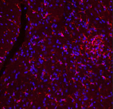 Reagente anticorpos - CH22134 - Neuromics - para pesquisa científica / para western blot / para imunohistoquímica