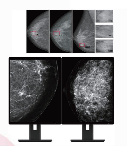 Monitor médico - MC50A - ZRT Technology - de diagnóstico / para mamografia / 21,3"