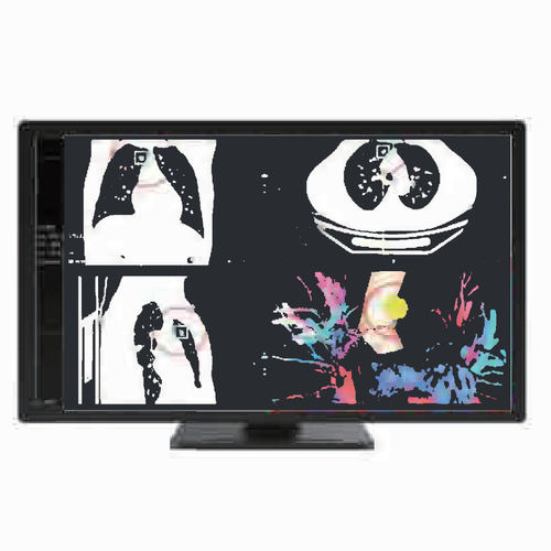 Monitor médico - MC80A - ZRT Technology - de diagnóstico / 3840 x 2160 / 31,5"