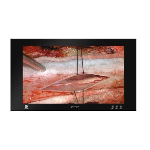 Monitor médico - MD8550T - ZRT Technology - para sala de cirurgia / para endoscopia / 3840 x 2160
