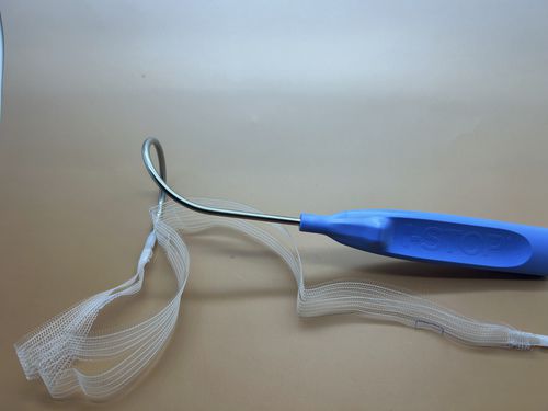 Implante de reconstrução para incontinência urinária - I-STOP TOMS - APIS Technologies - via transobturadora / de homem