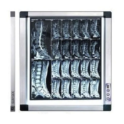 Negatoscópio digital - MV-FV4 - Mediveron - 1 corpo / LED / com luminosidade ajustável