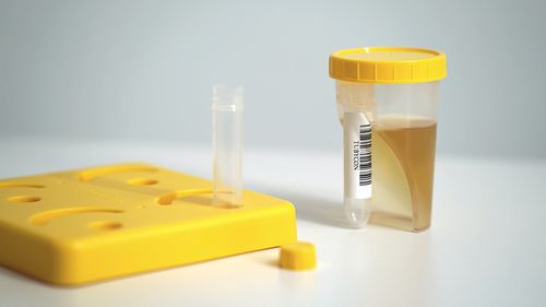 Suporte de laboratório para tubos de ensaio - TUBYCON Inc.