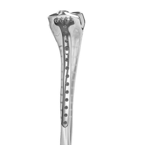 Placa de compressão óssea para tíbia - Aplus Biotechnology - proximal / medial / bloqueada