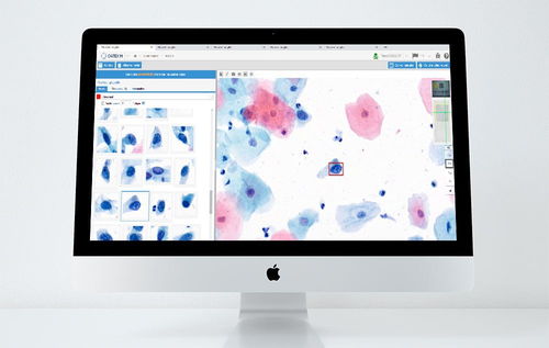 Plataforma de IA para pesquisa médica - CYTOPROCESSOR® - DATEXIM - para laboratório / de despistagem do câncer do colo do útero / baseada em tecnologia Web