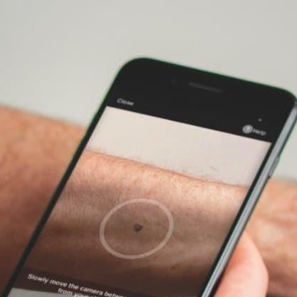 Aplicativo Web de diagnóstico cutâneo - SkinVision - Skinvision - para dermatologia / Android / iOS
