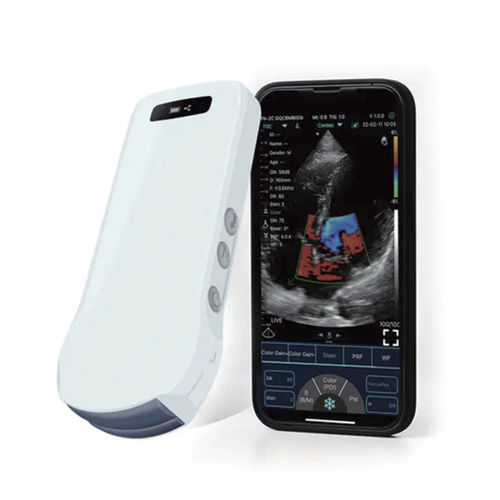 Aparelho de ultrassom de bolso - YSB-C10T - YSENMED - geral / em preto e branco / com Doppler colorido