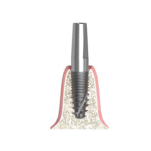 Pilar para implante cilíndrico cônico - Actival - Bionika Medline Kft. - em titânio / interno / reto