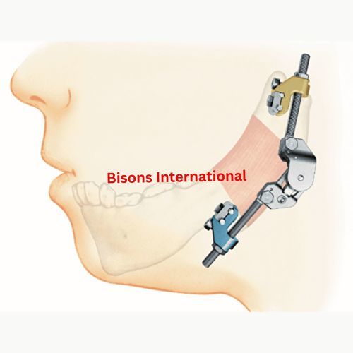 Distrator maxilar - BI-001477 - Bisons International - craniano / externo