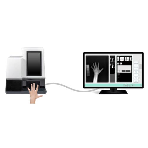 Sistema de radiografia digital - MedAlliance Inc. - para radiografia das articulações / para radiografia pediátrica