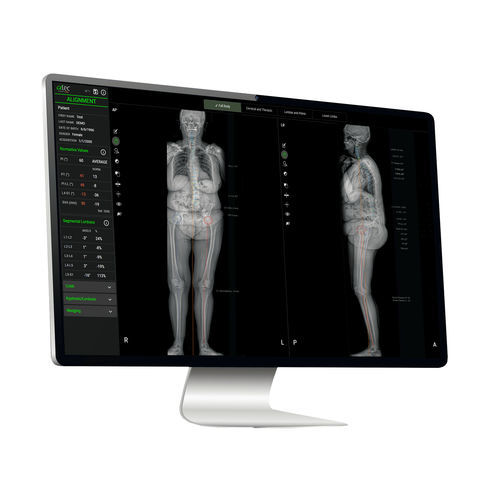 Plataforma de IA para o setor médico - EOS IMAGING - para exames de imagem / para quantificação / de aprendizado de máquina