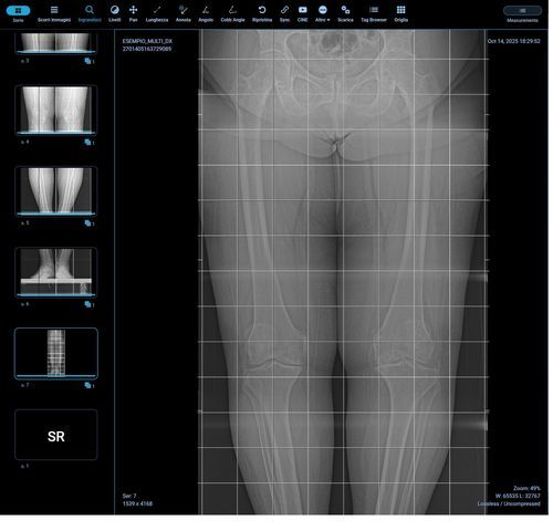 Módulo de software de medição - Orthogrid - G-Squared - de análise de imagens / para radiologia / corpo