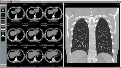 Software visualizador DICOM - EyeLite - G-Squared - médico-hospitalar / de teleconsulta / Windows