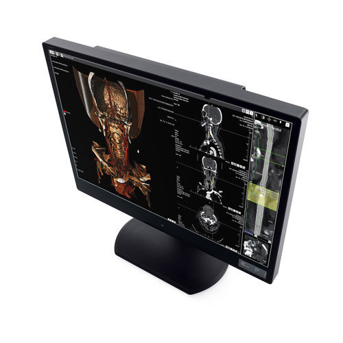 Monitor de diagnóstico - CW60N - Wide USA Corporation - para exames de imagem / 30" / LCD