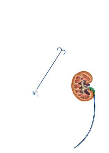 Bainha de acesso ureteral - FY series - Hunan Endovascular Device Co., Ltd. - renal / orientável / atraumática