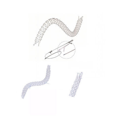 Stent ureteral - EUS0919514 - Hunan Endovascular Device Co., Ltd. - em nitinol / de revestimento