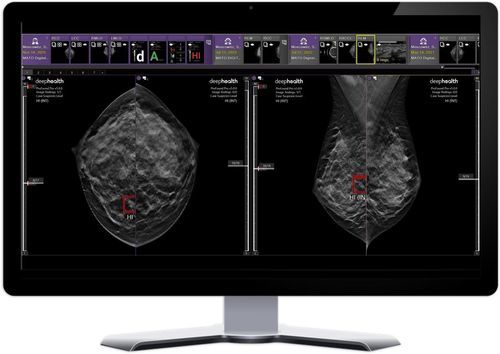 Plataforma de IA para hospital - DeepHealth - para exames de imagem / de aprendizado de máquina / visualizador