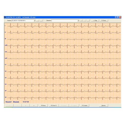 Software para eletrocardiografia - CARDIOTEKA v.211SOFT - ASPEL  - de diagnóstico / de monitorização / de coração