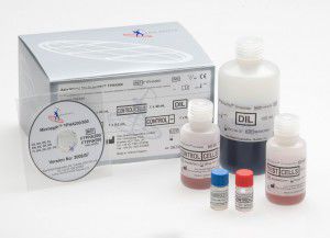 Teste rápido de sífilis - FTPHA200 - Axis-Shield PLC  - de Treponema pallidum / de soro / de plasma