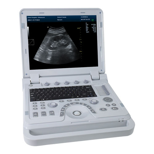 Ultrassom veterinário portátil - CMS1700A-VET - Contec Medical Systems - multiuso / em preto e branco / com Doppler colorido