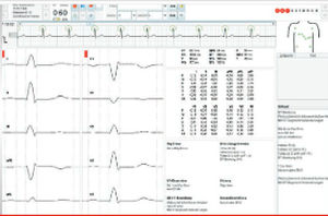 Algoritmo de diagnóstico - ECG algorithms - Corscience GmbH & Co. KG - de análise / para ECG