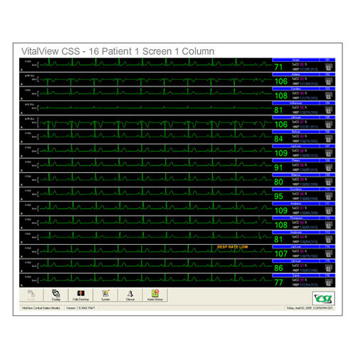 Central de monitoramento paciente - VitalView® CSS - Criticare Systems - 16 camas