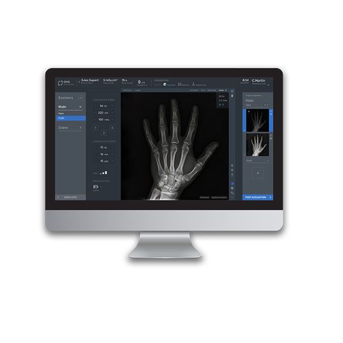 Software de aquisição - ADAM - DMS Imaging - de tratamento / para radiologia / Windows