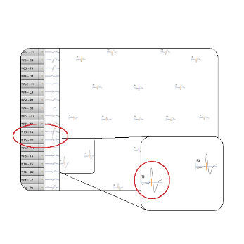 Software de visualização - Net Station 5.4  - Electrical Geodesics - de aquisição / clínico / para EEG