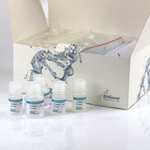Kit de reagentes em solução - EliGene® - Elisabeth Pharmacon spol  - clínico / para coleta de saliva / para extração de DNA