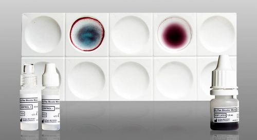 Teste rápido de mononucleose - ELITex Bicolor Mono - ELITech Group  - de anticorpos / do vírus Epstein-Barr / de sangue