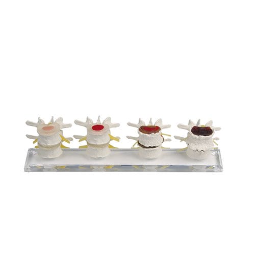 Modelo anatômico de vértebras - 7577 - Erler-Zimmer - para treinamento / flexível / em kit