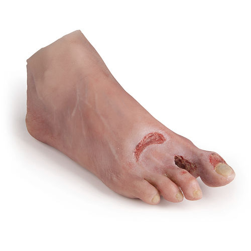 Simulador de tratamento de feridas - PW007 - Erler-Zimmer - para enfermagem / para diabetes / de pé