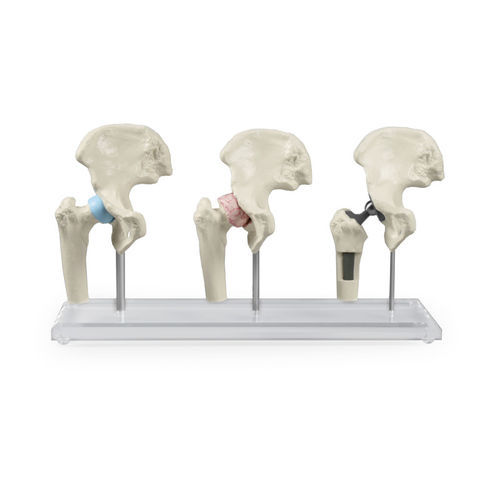 Modelo anatômico de quadril - 1115 - Erler-Zimmer - de articulação / para implantodontia / para cirurgia ortopédica
