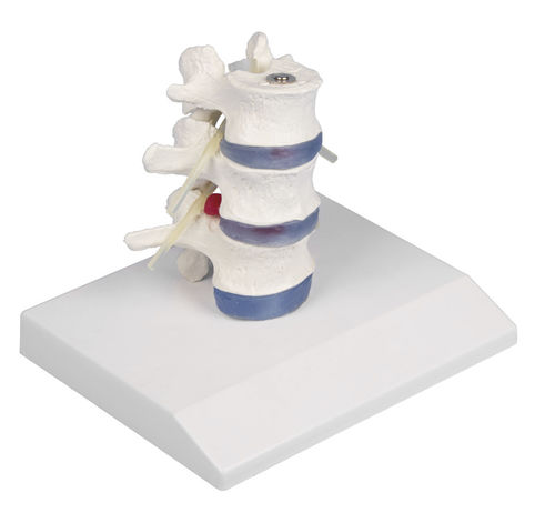 Modelo de medula espinhal - 4047 - Erler-Zimmer - lombar / de discos intervertebrais