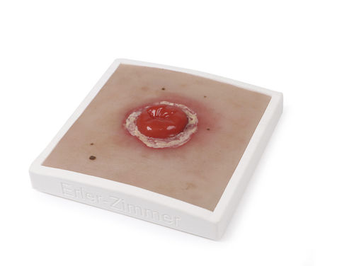Simulador de tratamento de feridas - PW022 - Erler-Zimmer - para treinamento / para cuidados de ostomia / em material plástico