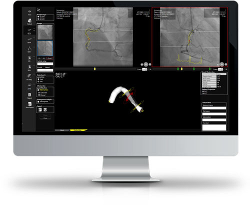 Software de análise - CAAS WORKSTATION - Esaote - de visualização / para angiografia