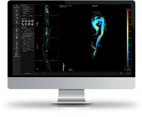 Software de análise - CAAS MR - Esaote - para RM / médico-hospitalar