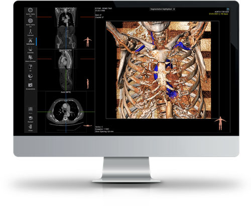 Software de visualização 3D - 3MENSIO - Esaote - de análise / médico-hospitalar / para TC