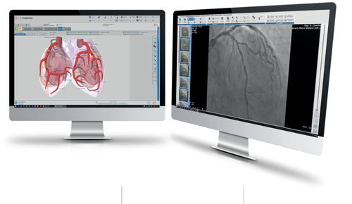 Software para cardiologia - SUITESTENSA CVIS - Esaote - médico-hospitalar / de criação de laudos / de análise