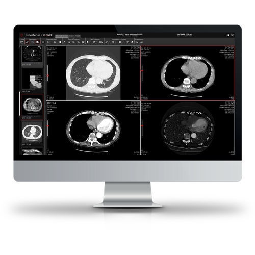 Software para exames de imagem - SUITESTENSA ZEfiRO - Esaote - de gestão / visualizador / de diagnóstico