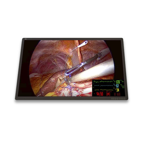Monitor médico - FM-C5501DV - FSN Medical Technologies - cirúrgico / 3840 x 2160 / 55"