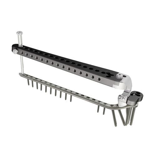 Placa de compressão óssea para tíbia - PTL - I.T.S.   - proximal / lateral / bloqueada