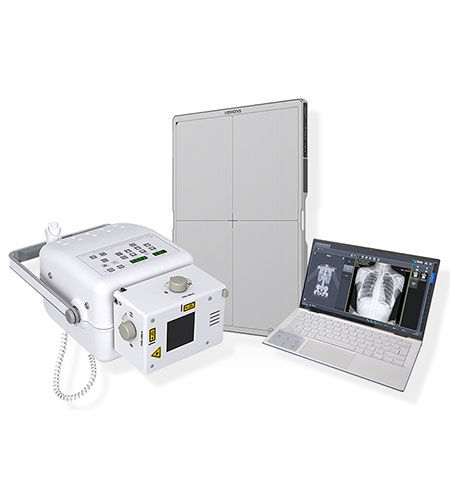 Sistema de radiografia digital - Home Ray - IBIS X Ray Systems - para radiografia geral / sem mesa / portátil