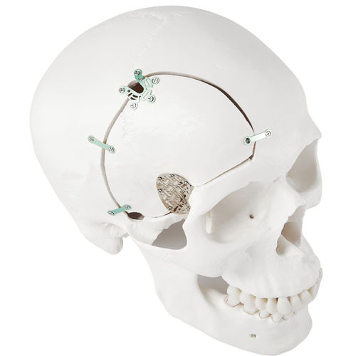 Sistema de fixação craniana não absorvível - LeForte Neuro 0.3 - Jeil Medical Corporation