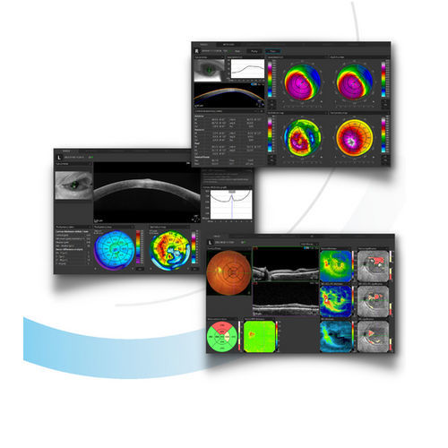 Software de análise - SOCT 11.5 - Optopol Technology - de captura / de oculometria / para oftalmologia