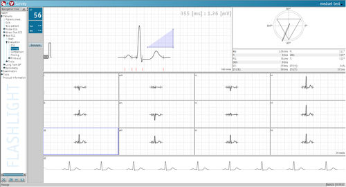 Software de análise - Medset Medizintechnik  - de medição / para ECG