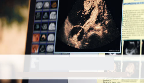 Software de criação de laudos - SonoWin&reg; - MESO - de arquivamento / de gestão de dados / de gestão de dados de paciente