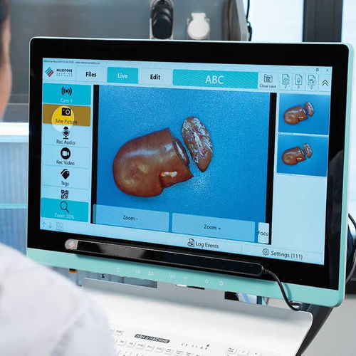 Dispositivo de eye tracking para pesquisa - LOOX - MILESTONE - de mesa