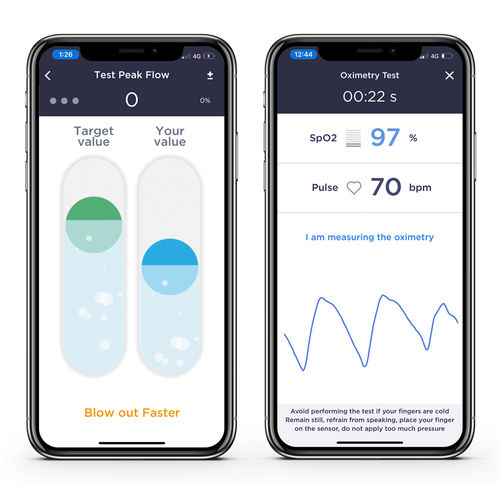 Aplicativo móvel de monitorização - Smart One  - MIR - Medical International Research - de gestão / de tratamento / de criação de laudos